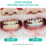 kf-S90dc3d250398445cbf5bf5b43070eeb5J-Rotation-Arm-Portable-Dental-Teeth-Whitening-Lamp-3-LED-Cold-Warm-Light-Bleaching-Machine-With-Stand