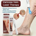 Laser Therapy Varicose Veins Relieve Blue Light Pen Effective Varicose Veins Relief Cream Phlebitis Spider Pain Treatment
