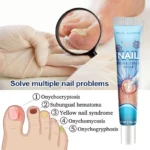 kf-S76c653305b934bc68e9669fac567ea015-Nail-Fungal-Cream-Treatment-Device-Repair-Toenail-Fingernail-Fungus-Treat-Onychomycosis-Laser-Nails-With-Mushrooms-Relaxation