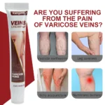 kf-S100f4698e5a04d9a94af8377491b0caao-Laser-Therapy-Varicose-Veins-Relieve-Blue-Light-Pen-Effective-Varicose-Veins-Relief-Cream-Phlebitis-Spider-Pain