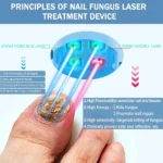 kf-Sa29a6b5cabfc405b811c56a44482f489b-Nail-Fungus-Laser-Treatment-Device-Repair-Toenail-Fingernail-Fungus-Treat-Onychomycosis-Laser-Nails-with-Mushrooms-Relaxation
